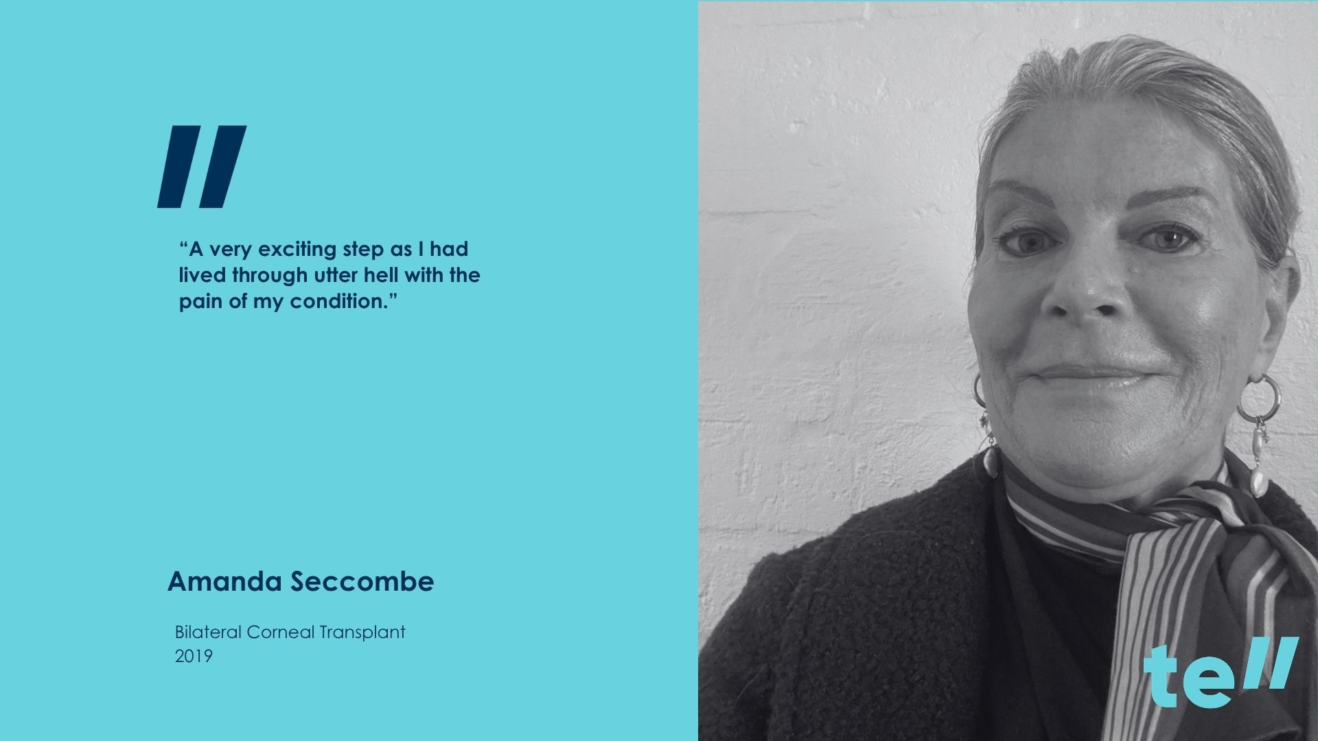 Cornea transplant Amanda Seccombe